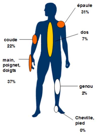 L Importance De L Ost Opathie Dans La Pr Vention Des Tms Ilycoach